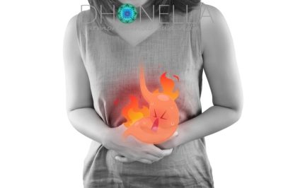 Você sofre de doença do refluxo? Esses erros pioram sua condição!